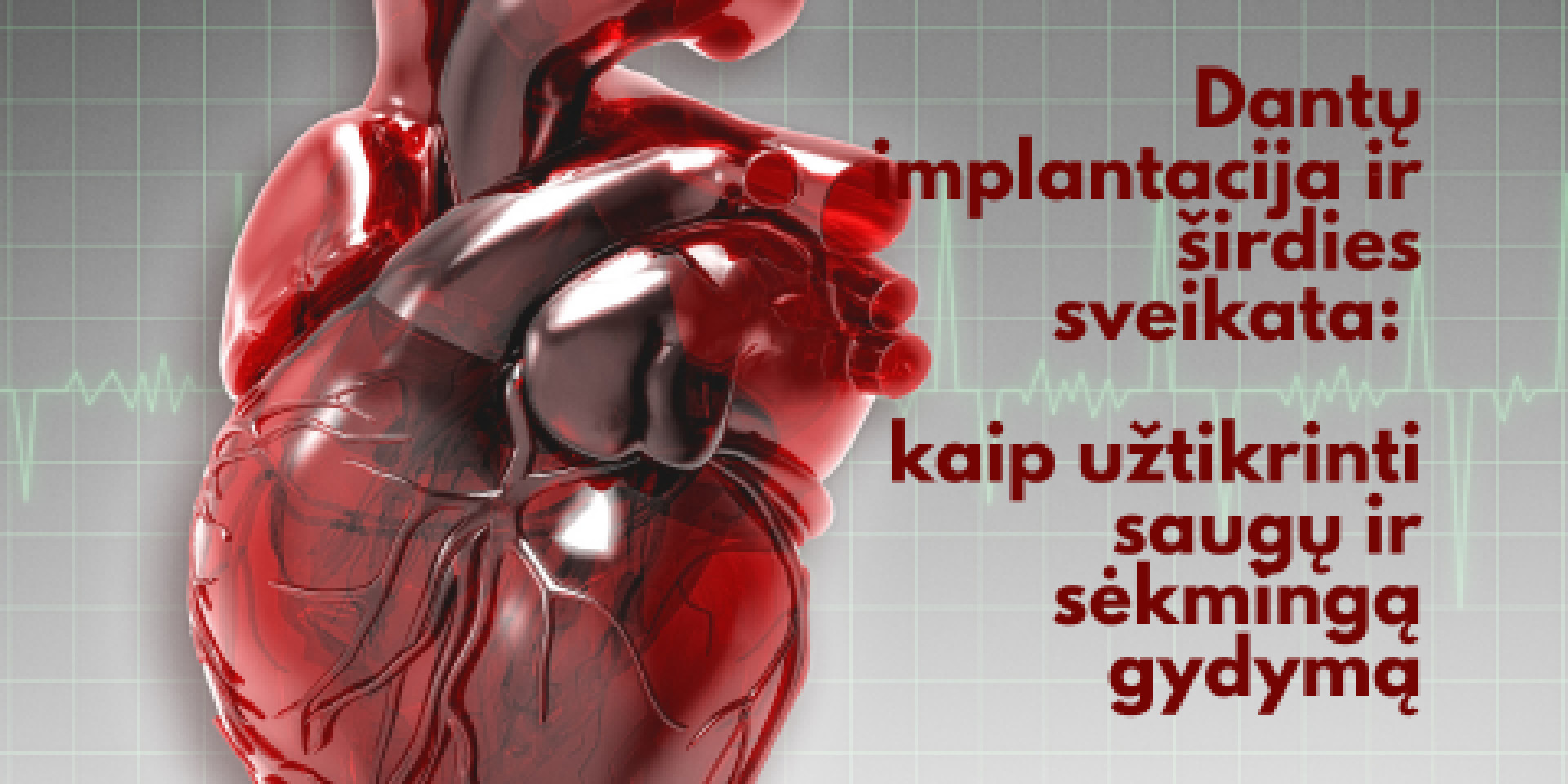 Dantų implantacija ir širdies sveikata: kaip užtikrinti saugų ir sėkmingą gydymą