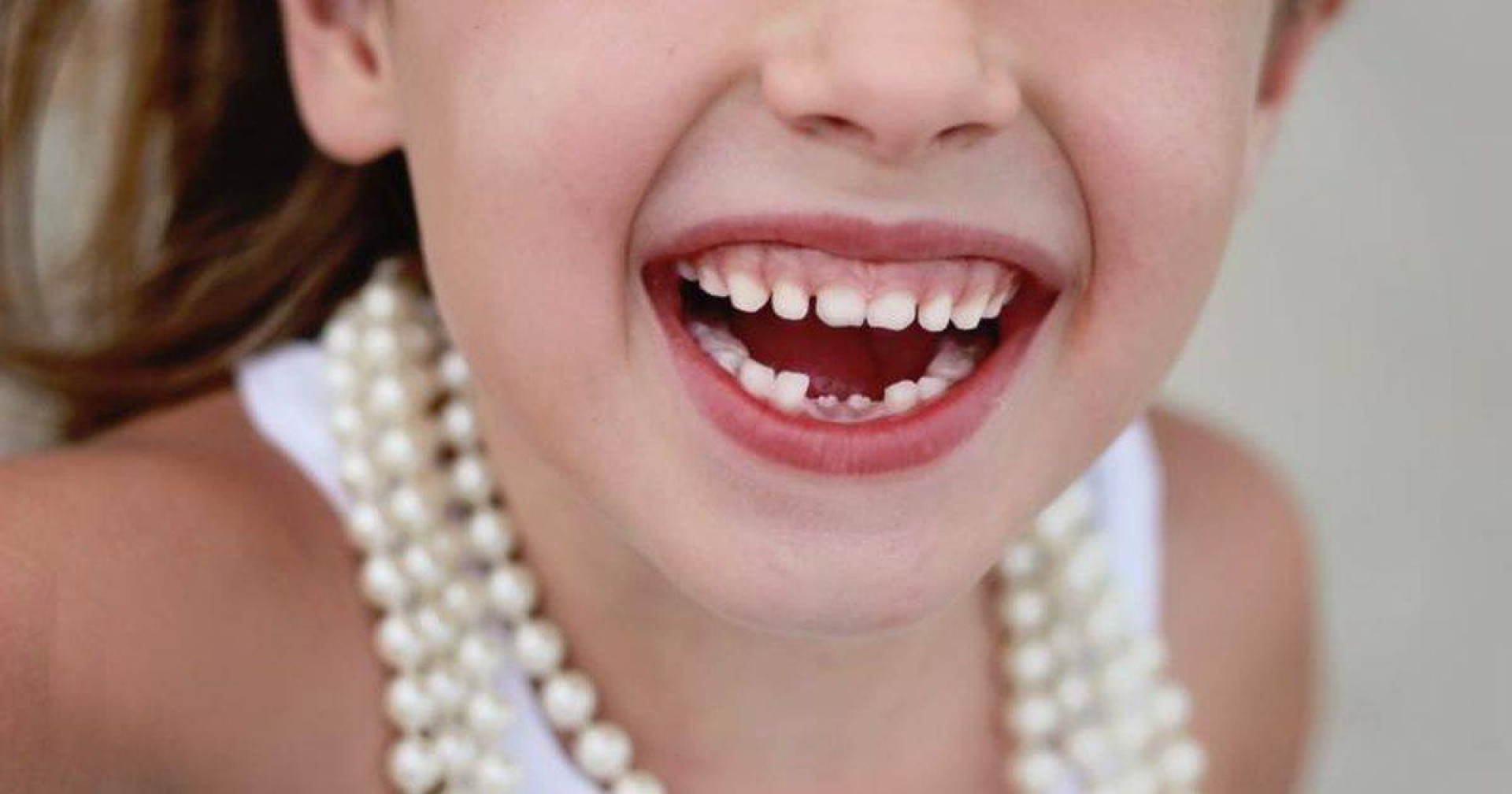 Ar vis dėlto reikia gydyti vaikų pieninius dantis?
